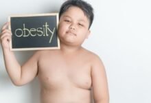 Obesity in Children