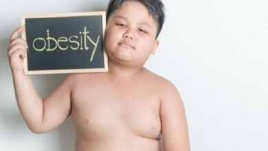 Obesity in Children