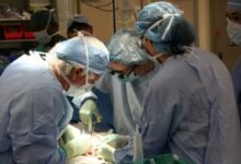 Pulmonary Transplantation, Lungs Transplant, Lungs Replacement, Operation For Lungs Transplant, Lungs Surgery